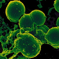 Alpha Screen Rapid Pathogen Screener for Bacterial Infections in Food/Water